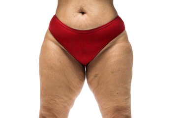 Overweight woman with fat cellulite legs and buttocks, obesity female body, White background. Front...