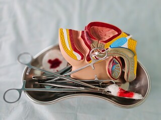 Scalpel and penis enlargement by ligament incision. Genital plastic surgery