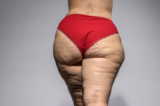 Overweight woman with fat cellulite legs and buttocks, obesity female body, Gray background. Back, rear view.