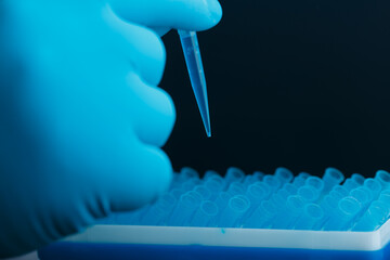 A scientist's hand in glove holds a pipette