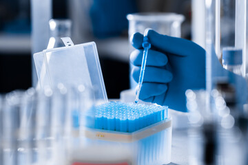 A scientist's hand in a medical glove holds a pipette