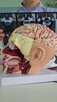 Doctor checks x-ray of brain using ST segment scanning. MRI of brain. Electroneuromyography