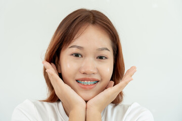 Treatment. Dental Care. Beautiful asian Woman Healthy Smile.Metal Brackets on Teeth. young Female Smile with Braces and show beautiful  of teeth, Care after braces, confident in orthodontics.