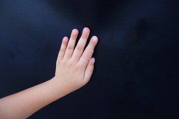 A toddler places his hand on a dark background where a toddler's index finger is being bandaged...