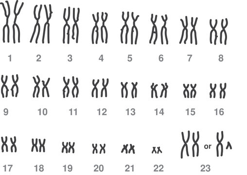 Metaphase chromosomes Karyogram/ Human Karyogram
