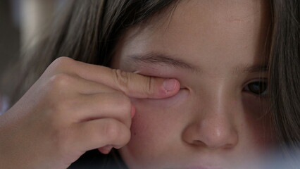Fototapeta premium Young girl rubbing her eye with her finger, showing a moment of discomfort or itchiness, as she presses gently on the corner of her eye