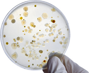 Bacterial Cultures in Petri Dishes in microbiology laboratory. Test various germs, virus, Coronavirus, Corona, COVID-19, Microbial population count, Food science.