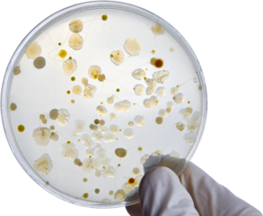 Bacterial Cultures in Petri Dishes in microbiology laboratory. Test various germs, virus, Coronavirus, Corona, COVID-19, Microbial population count, Food science.