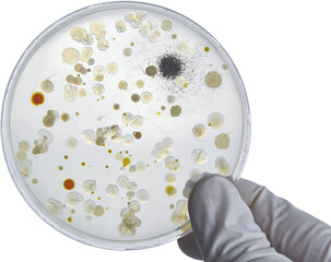 Bacterial Cultures in Petri Dishes in microbiology laboratory. Test various germs, virus,...