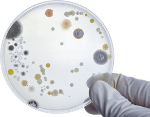 Bacterial Cultures in Petri Dishes in microbiology laboratory. Test various germs, virus,...