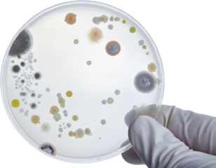 Bacterial Cultures in Petri Dishes in microbiology laboratory. Test various germs, virus, Coronavirus, Corona, COVID-19, Microbial population count, Food science.