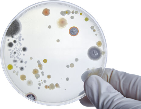 Bacterial Cultures in Petri Dishes in microbiology laboratory. Test various germs, virus, Coronavirus, Corona, COVID-19, Microbial population count, Food science.