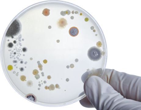 Bacterial Cultures in Petri Dishes in microbiology laboratory. Test various germs, virus, Coronavirus, Corona, COVID-19, Microbial population count, Food science.