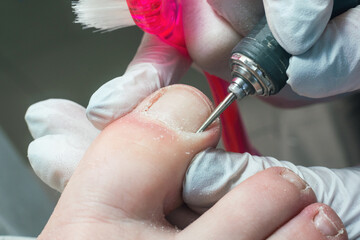 Professional hardware pedicurist, podiatrist cleaning nails using a nail miller