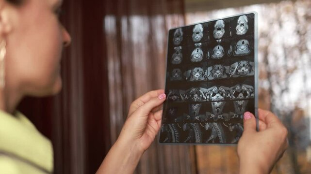 Computed tomography of the thyroid gland.