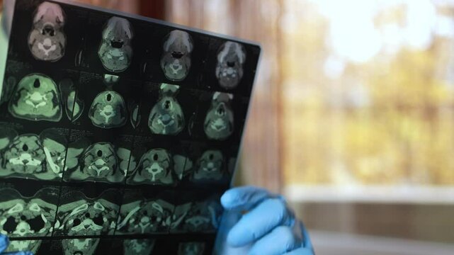 Computed tomography of the thyroid gland.