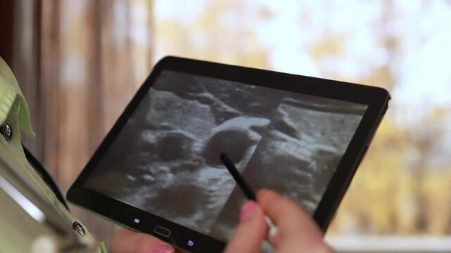Ultrasound examination of the thyroid gland.