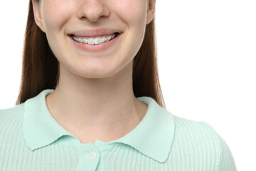 Girl with braces on white background, closeup