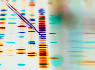 Gene Editing, Conceptual image of a micro pipette editing human DNA.