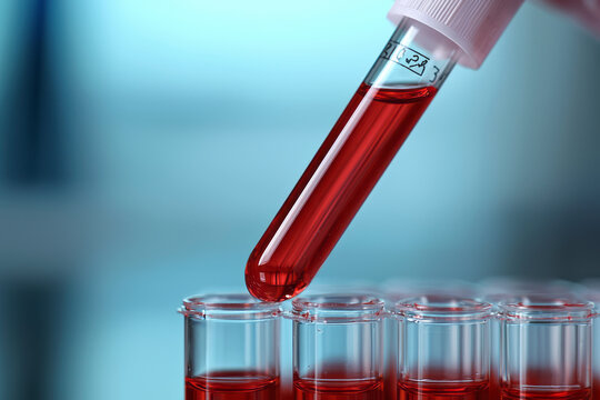 Genetic Hemophilia Testing: Blood Sample Analysis for Inherited Condition