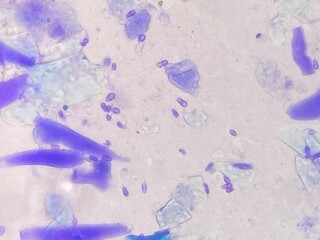 Fototapeta premium Microscopic view of Malassezia pachydermatis cells taken from dog with ear infecion