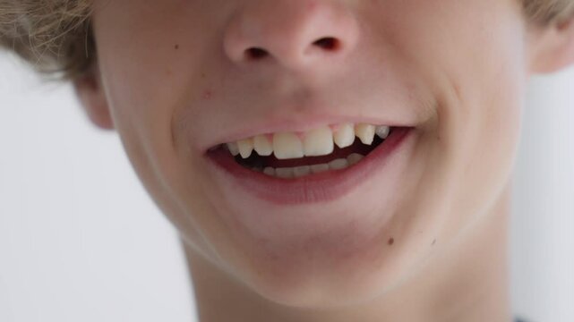 teenager smiling laughing and looking at camera, showing white teeth, opened mouth. Visiting dentist. Dental teeth. Kid's child's White straight healthy teeth 