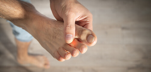 Caucasian man with pain in foot.