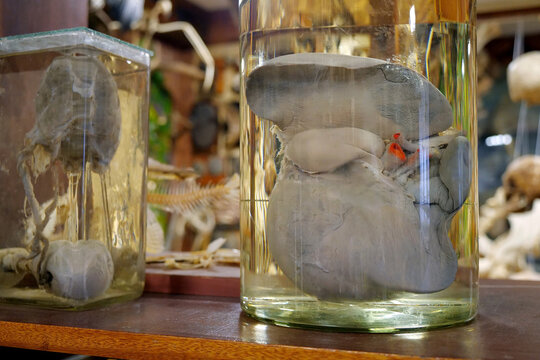 Human liver in glass flask. Major metabolic organ