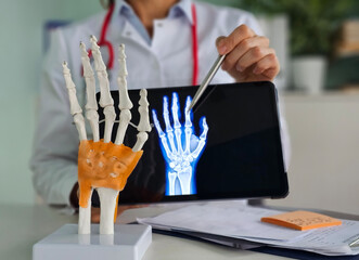 A doctor examines a model of a hand skeleton while pointing to an X-ray image on a tablet