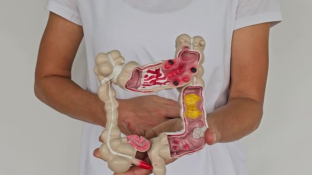 Woman holding human colon anatomy model on white background