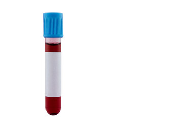 Empty labeled blood sample tube with a blue cap, isolated on a white background.