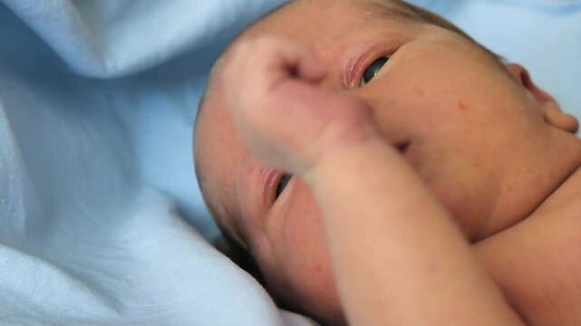 A close-up of a baby's face against a blue sheet. The skin of the face is pimpled and has a yellowish colour. The newborn moves his hands. Mild jaundice of the newborn