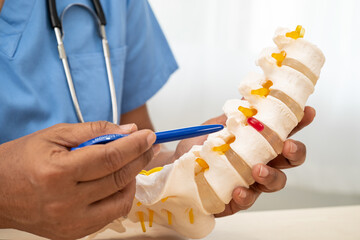 Doctor with lumbar vertebra bone skeleton and nerve model for treatment in the orthopedic...