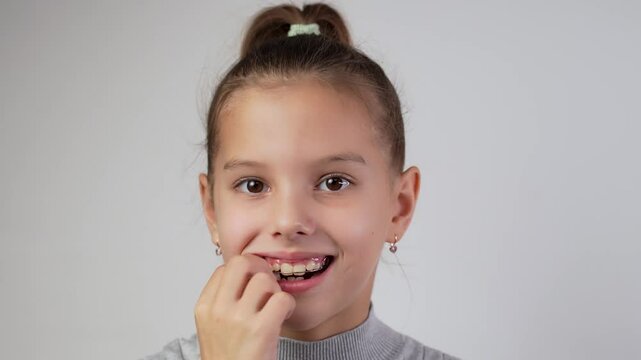 Pretty girl wearing braces smiling, looking at camera, close-up. Girl with dental braces or teeth retainers for teeth correction