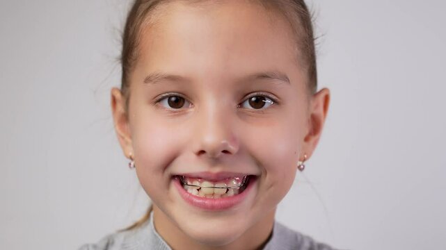 Girl with dental braces or teeth retainers for teeth correction. Pretty girl wearing braces smiling, looking at camera, close-up.