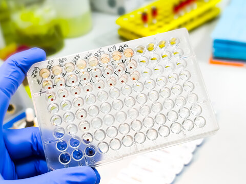 Hemagglutination assay for T. pallidum antibodies. TPHA. ELISA plate, serology testing method in medical laboratory