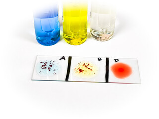 Blood group testing by slide agglutination method, show AB Negative result.