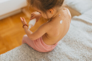The photo captures a small child managing chickenpox by applying soothing lotion to her back with...