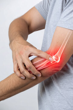 Elbow Pain Illustration with X-Ray Highlighting Tendonitis &ndash; Medical Concept Image for Injury and Joint Issues