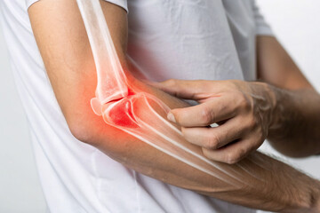 Elbow Pain Illustration with X-Ray Highlighting Tendonitis – Medical Concept Image for Injury and Joint Issues