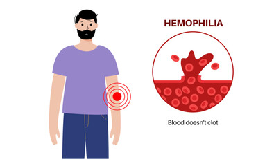 Hemophilia medical poster