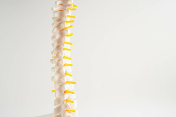 Spinal nerve and bone, Lumbar spine displaced herniated disc fragment, Model for treatment medical...