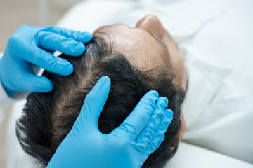 Specialist of hair check health of hair for Asian man, damaged hair, hair loss, thinning problem, vitamin deficiency, baldness, postpartum, biotin, zinc, endocrine disorders, hormonal imbalance