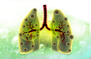 Sars covid-19 infection in respiratory system. 3d illustration..