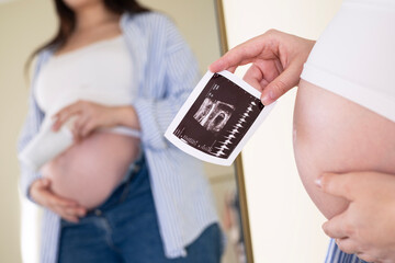Pregnant woman is looking at an ultrasound photo of fetus. Mother gently touches the baby on stomach. Happy, family, growth, pregnancy, enjoyment , prepare newborn, take care, healthcare, tummy.