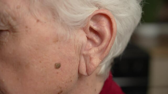 Elderly woman ear close-up. Issues with hearing, inflammation, infections of eardrum. Close up old human ear and hair. Cheek with mole or wart, benign skin growth. Care for elderly persons medicine