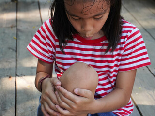 A young girl injured her knee while playing outdoors on a playground. Wounded knee of the child.