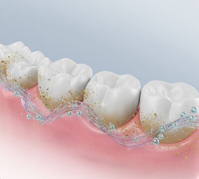 Tooth whitening, Tooth Cleaning, Healthy gums and teeth with fluoride Liquid Bubble Protect and Cleaning. Oral hygiene and Dental concept, 3d rendering.