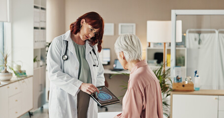 Brain, scan and old woman with doctor, tablet and consultation for healthcare advice in office....