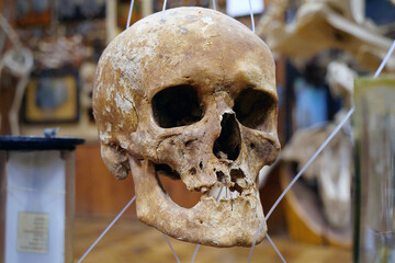Bones of human skull for studying. Human skull